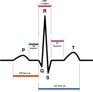 EKG