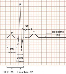 EKG graph