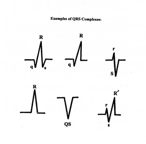 QRS's